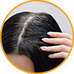 WOW Skin Science Amla Hair Oil